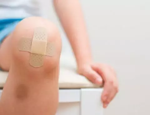 Tips Mudah Hilangkan Luka