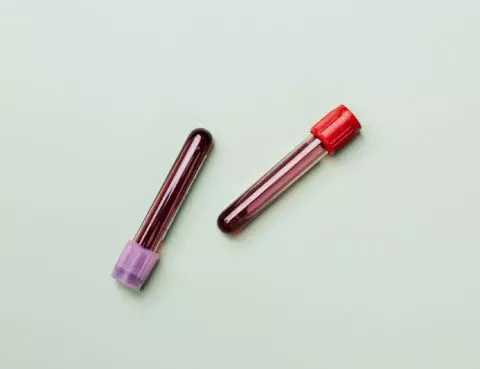 Tipe Anemia